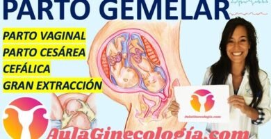 ¿Cuánto puede durar un parto de gemelos?