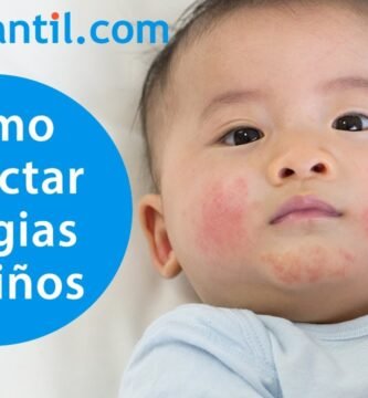 Cómo identificar alergias en recién nacidos