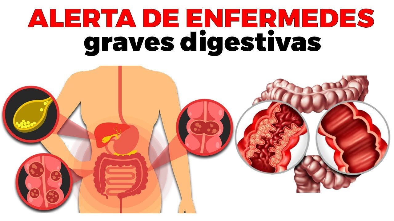 Errores comunes sobre el maduración del sistema digestivo